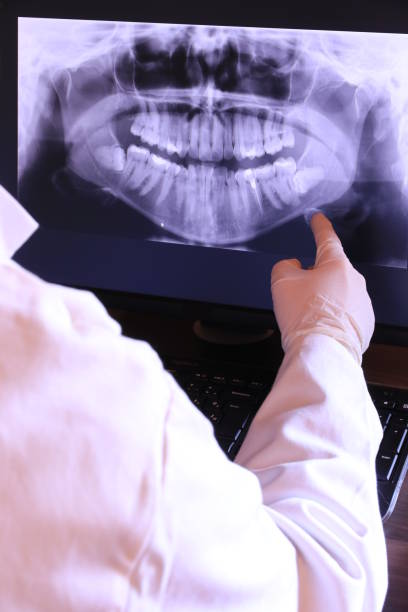 Best Emergency Broken Tooth Repair in Doe Valley, KY